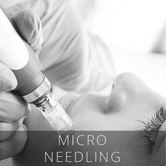 micro needling Wilmington